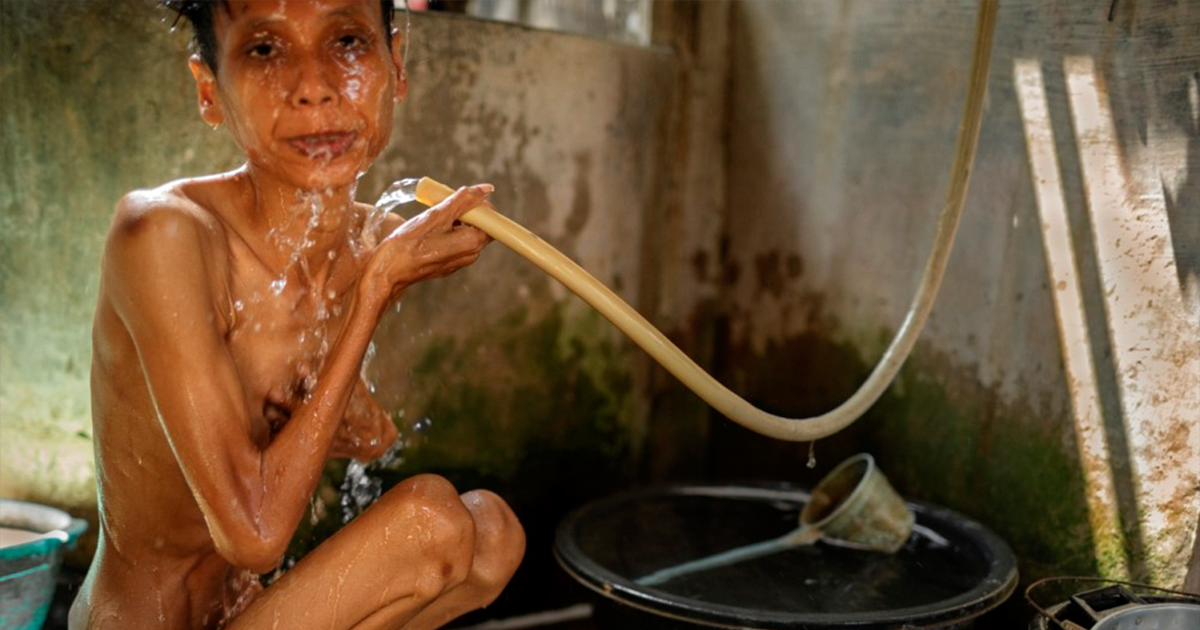 Des photos déchirantes de malades mentaux en Indonésie montrent leurs conditions de vie troublantes