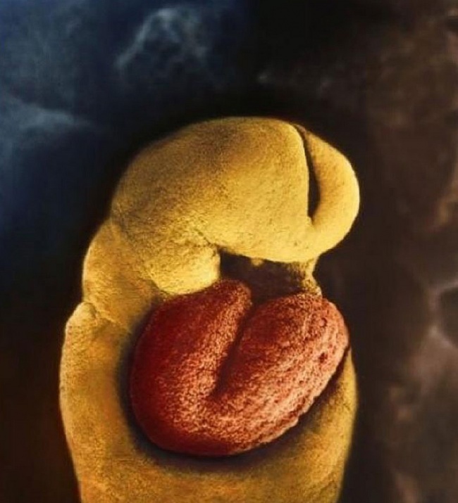 embryon-humain-lennart-nilsson-07