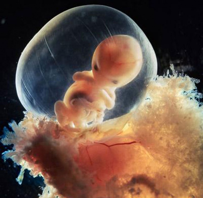 embryon-humain-lennart-nilsson-10