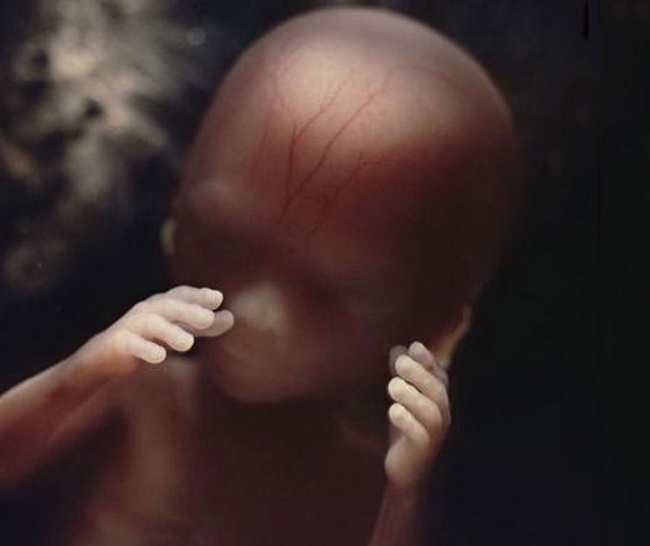 15 photos à couper le souffle qui montrent le début de la vie d’un enfant, de la conception à la naissance