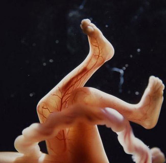 15 photos à couper le souffle qui montrent le début de la vie d’un enfant, de la conception à la naissance
