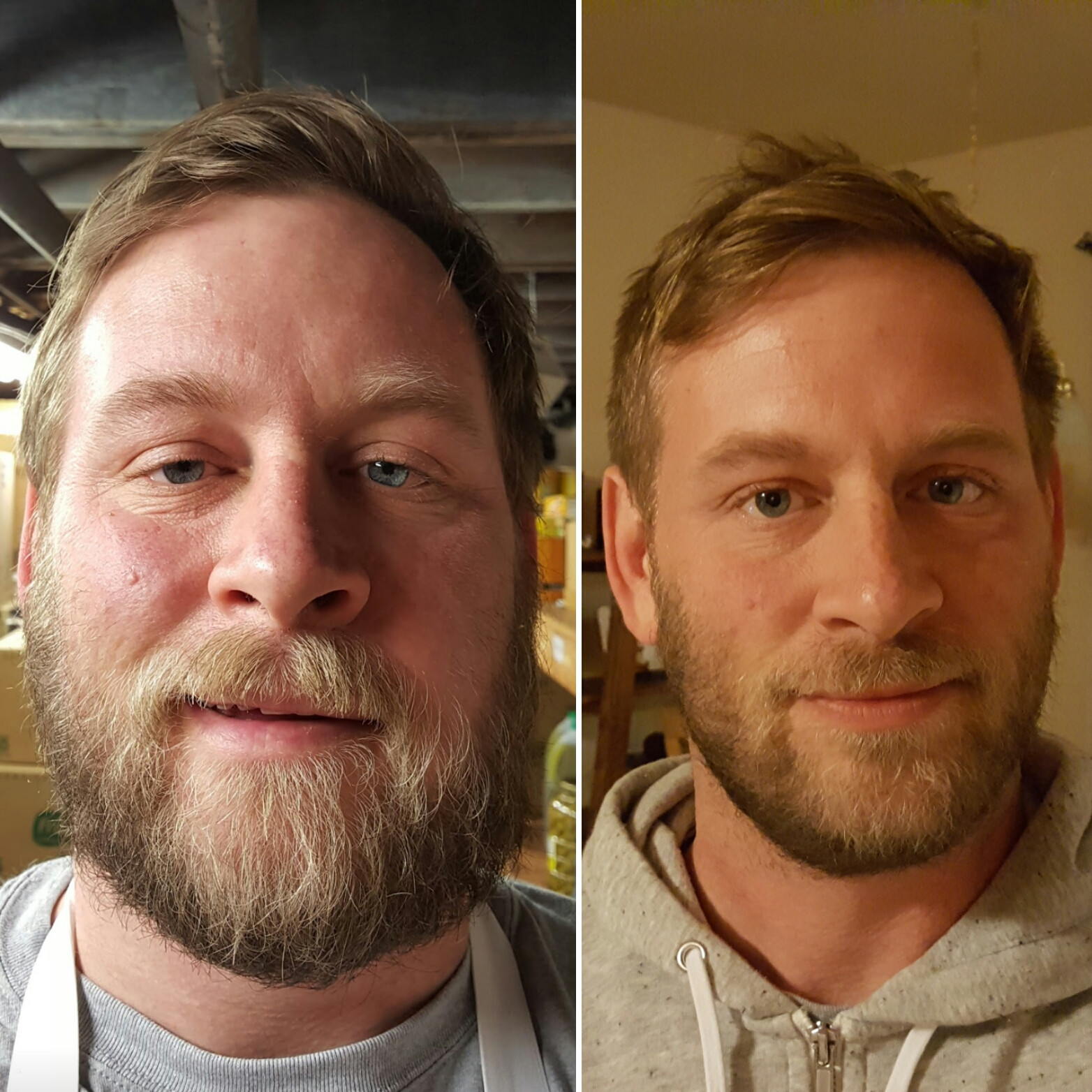 20 photos avant et après qui montrent ce qui arrive quand vous arrêtez de boire de l’alcool