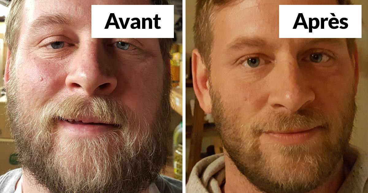 20 photos avant et après qui montrent ce qui arrive quand tu arrêtes de boire de l’alcool