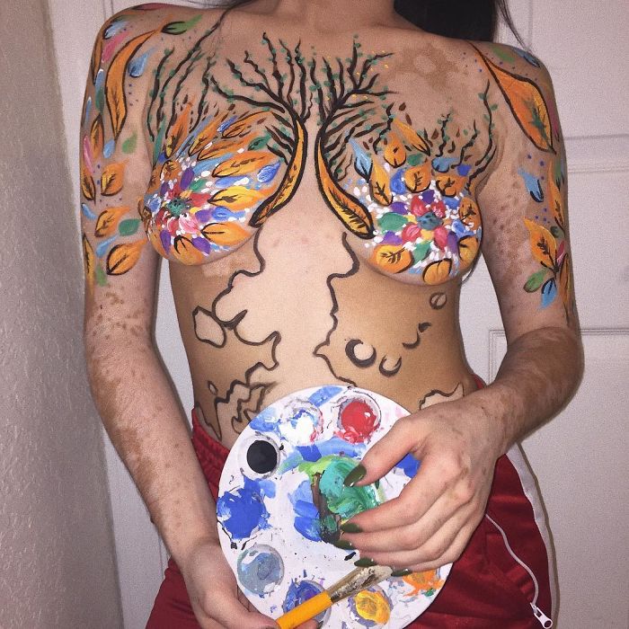 Ridiculisée toute sa vie à cause du vitiligo, elle décide de transformer son corps en oeuvres d’art