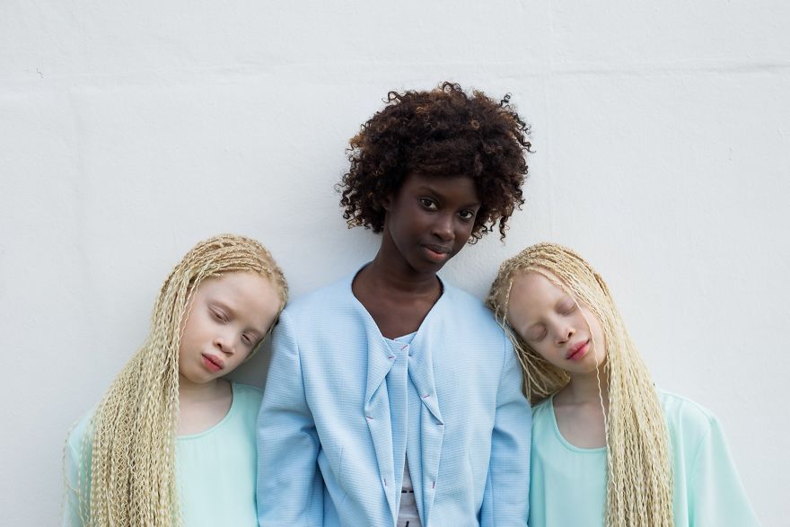Ces jumelles albinos font fureur dans le secteur de la mode grâce à leur beauté unique