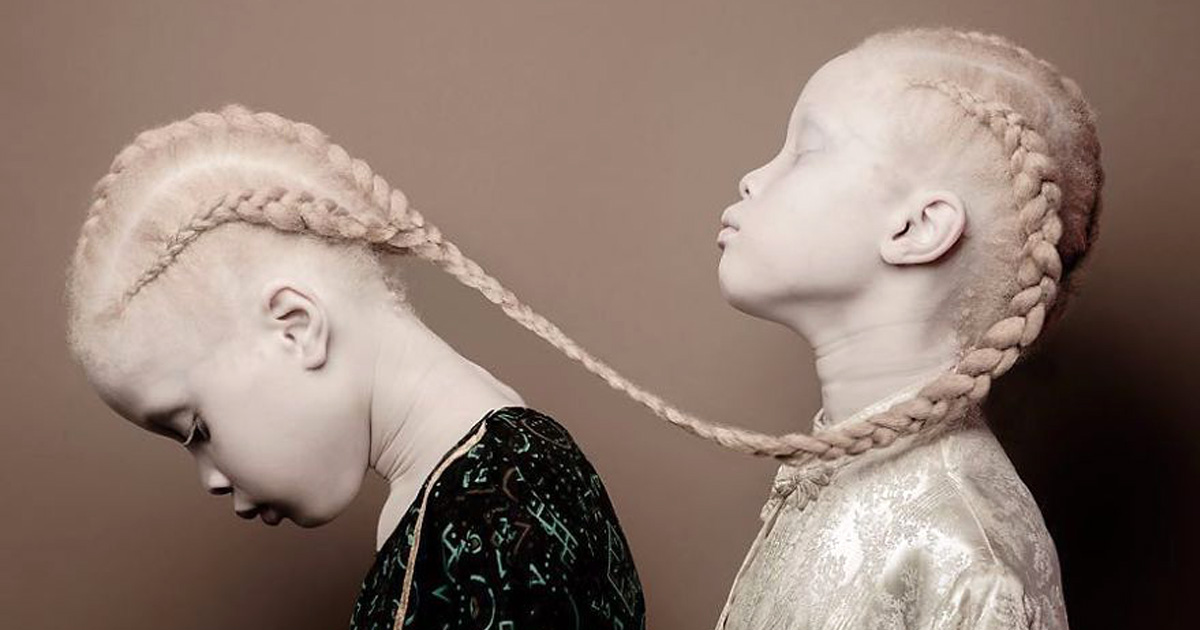 Ces jumelles albinos font fureur dans le secteur de la mode grâce à leur beauté unique