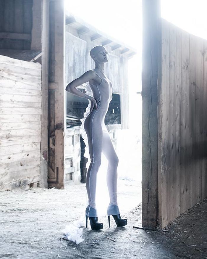 Cette mannequin de 28 ans atteinte d’une rare maladie génétique fracasse les stéréotypes de la mode