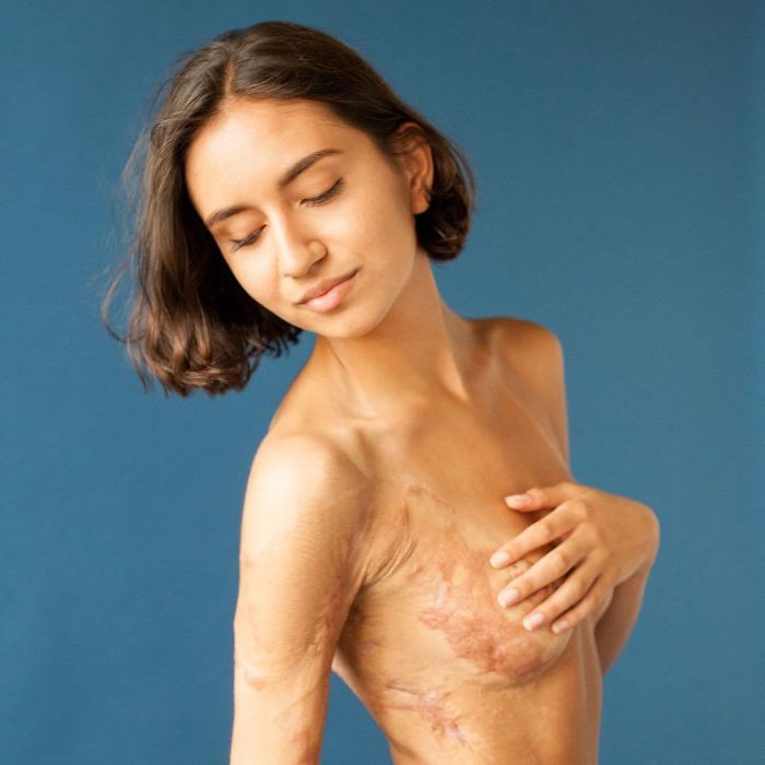 Des gens révèlent leurs cicatrices et comment ils les ont eues dans une puissante série de photos
