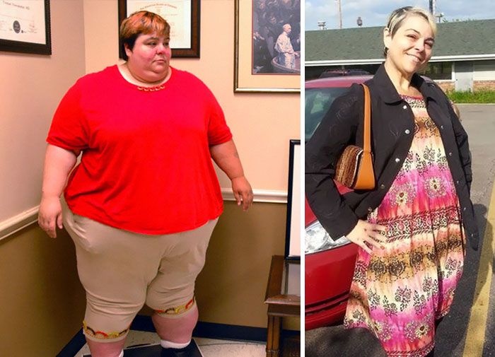 25 photos prises avant et après des transformations incroyables de personnes pesant environ 300 kilos