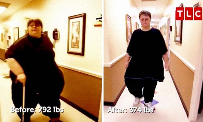 25 photos prises avant et après des transformations incroyables de personnes pesant environ 300 kilos