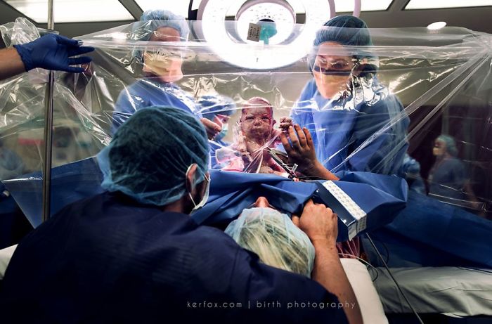 Ces 20 puissants clichés explicites du concours de photos de naissance 2018 prouvent que les mères sont extraordinaires