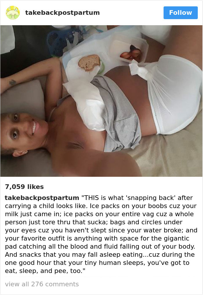 28 photos honnêtes de corps post-accouchement que les femmes partagent pour révéler la vérité dont personne ne parle