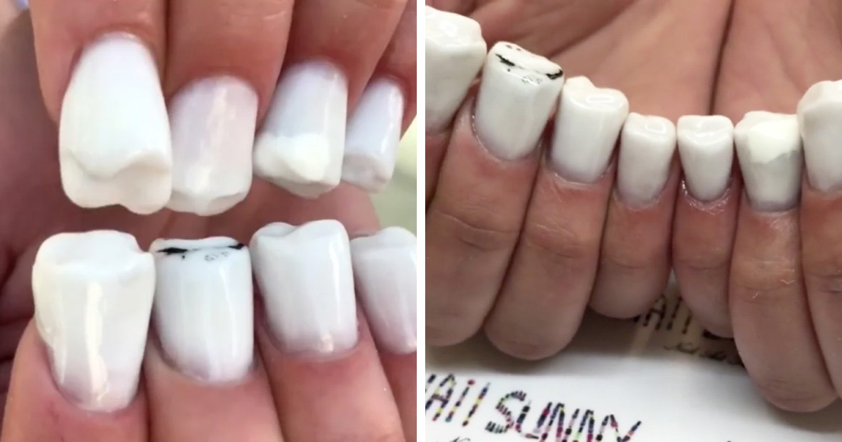 Les Ongles En Forme De Dents Existent Et Si Vous Pensez Que