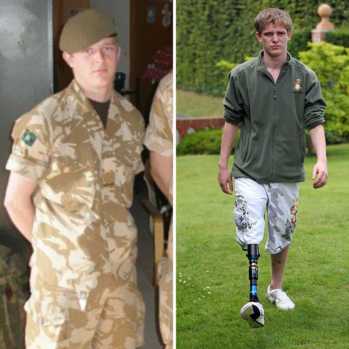 Les internautes ne peuvent pas croire que ce soldat amputé a répondu comme ça à l’homme musulman qui l’a fait exploser