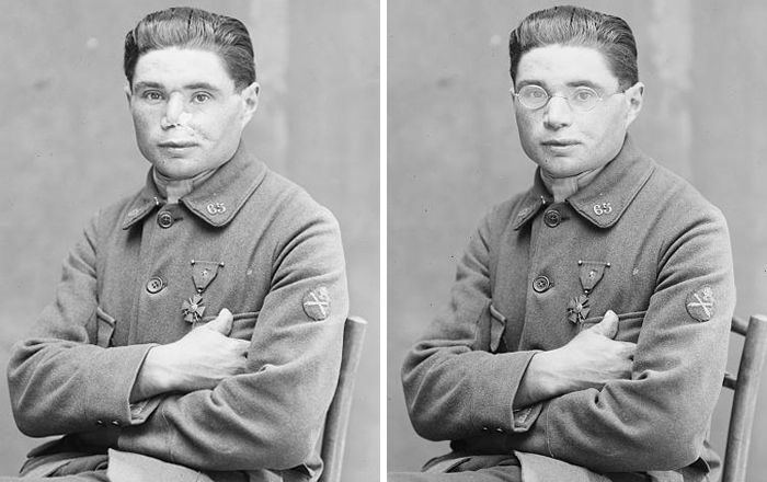 Ces photos fascinantes avant et après montrent comment cette femme a changé la vie d’anciens combattants de la Première Guerre mondiale en «&nbsp;restaurant&nbsp;» leurs visages