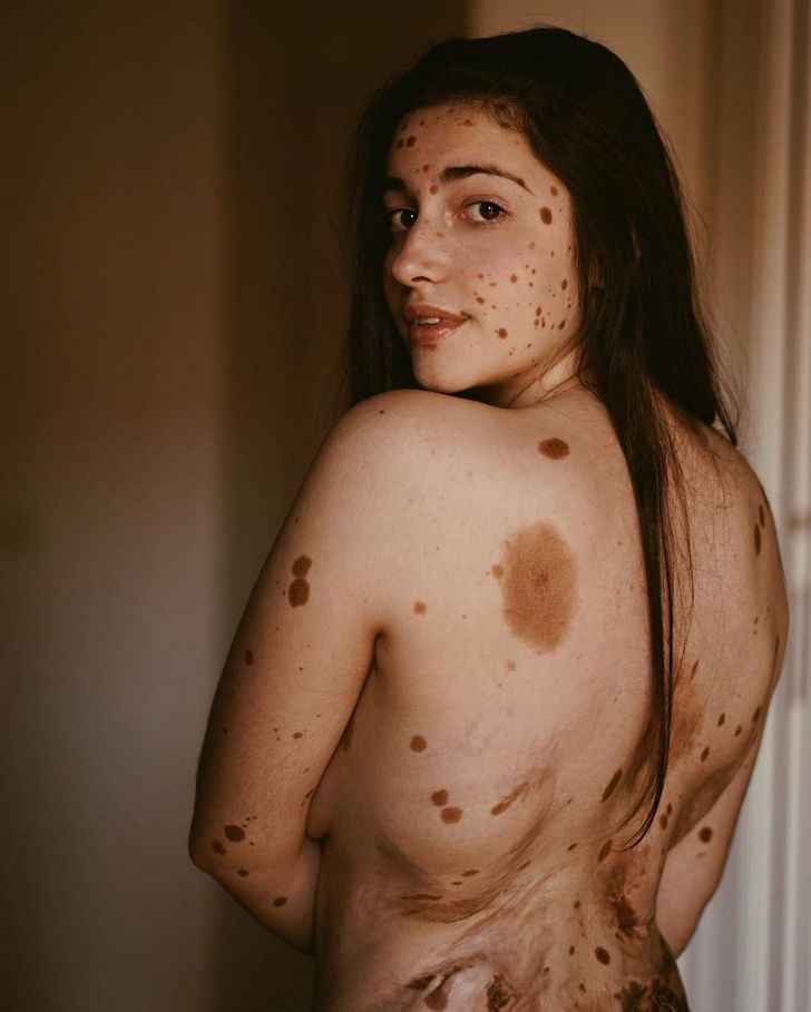 Des gens partagent des photos des parties insolites de leur corps et les internautes veulent en voir plus