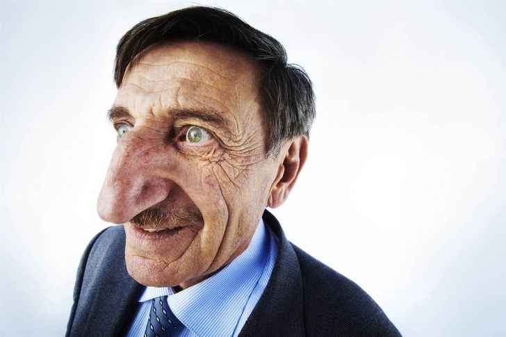 Des gens partagent des photos des parties insolites de leur corps et les internautes veulent en voir plus