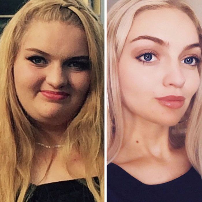 Une adolescente en surpoids a surpris tout le monde en perdant 64 kilos pour pouvoir porter sa robe de soirée