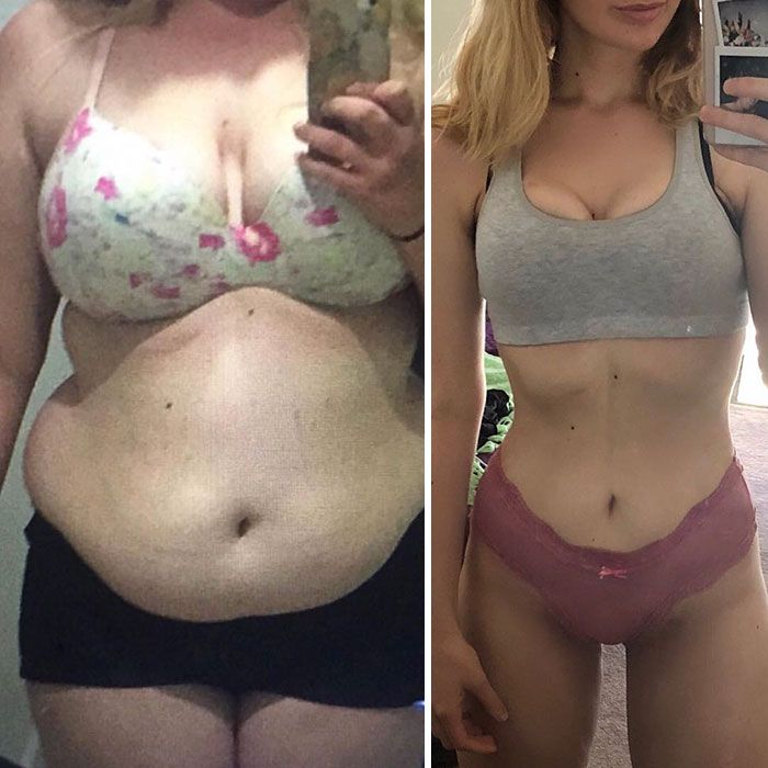 Une adolescente en surpoids a surpris tout le monde en perdant 64 kilos pour pouvoir porter sa robe de soirée