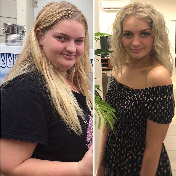 Une adolescente en surpoids a surpris tout le monde en perdant 64 kilos pour pouvoir porter sa robe de soirée
