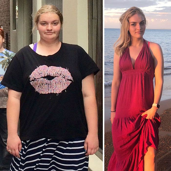 Une adolescente en surpoids a surpris tout le monde en perdant 64 kilos pour pouvoir porter sa robe de soirée