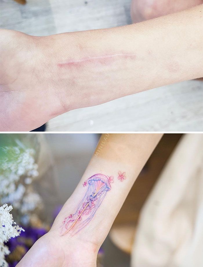 33 fois où des gens ont voulu camoufler leurs cicatrices et taches de naissance et les tatoueurs ont assuré