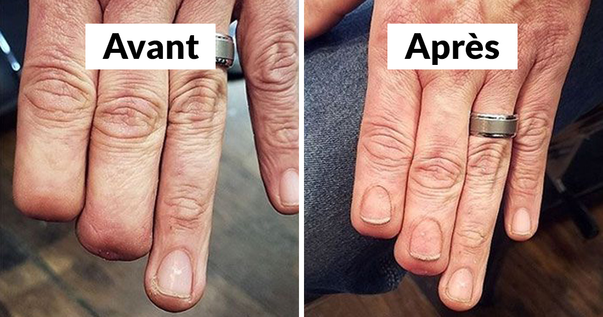 33 fois où des gens ont voulu camoufler leurs cicatrices et taches de naissance et les tatoueurs ont assuré