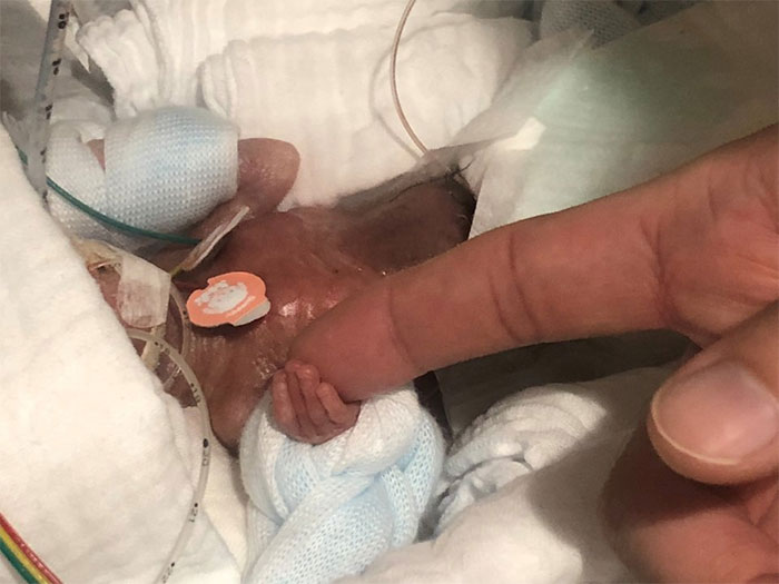 Après avoir passé des mois à l’hôpital, le plus petit bébé prématuré survivant du monde a finalement été renvoyé chez lui