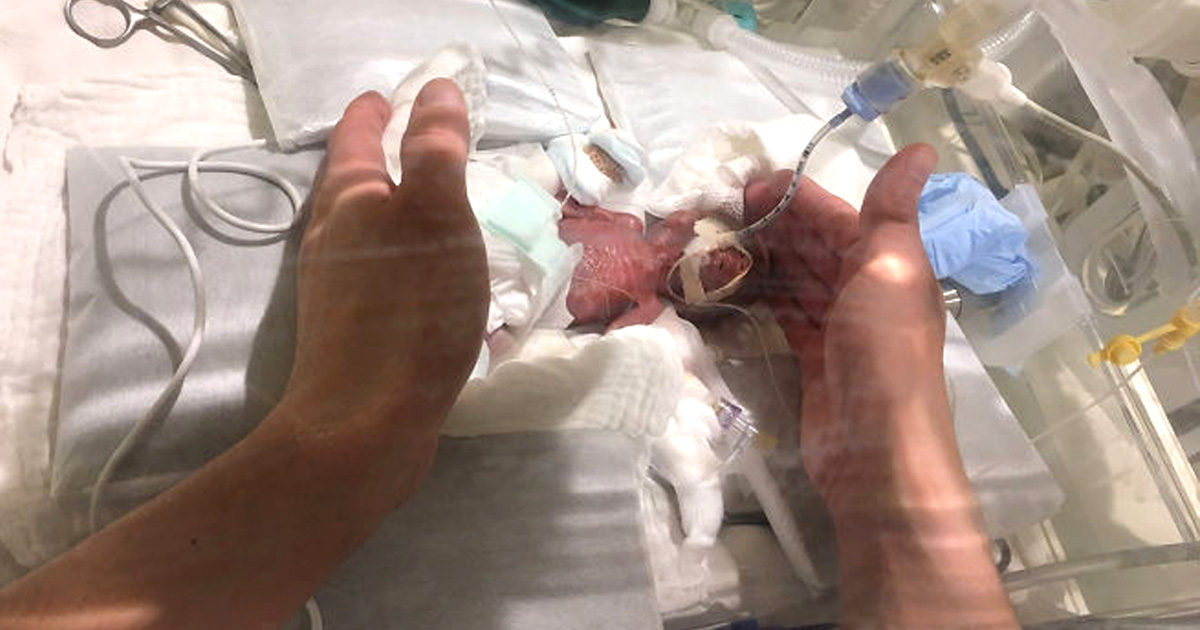 Après avoir passé des mois à l’hôpital, le plus petit bébé prématuré survivant du monde a finalement été renvoyé chez lui