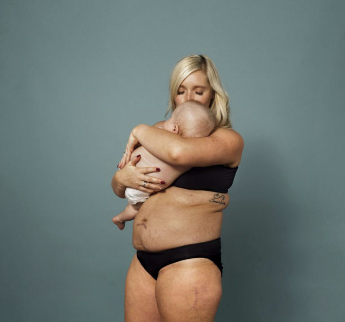 10 femmes ont montré leur corps après l’accouchement pour mettre fin aux attentes irréalistes concernant les nouvelles mamans