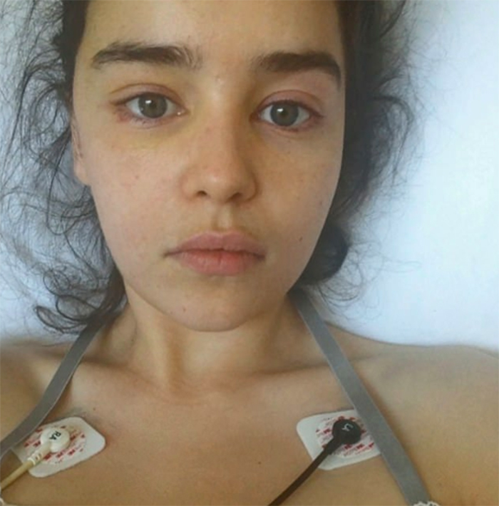 Emilia Clarke a partagé 5 photos inédites prises à l’hôpital après avoir eu deux anévrismes