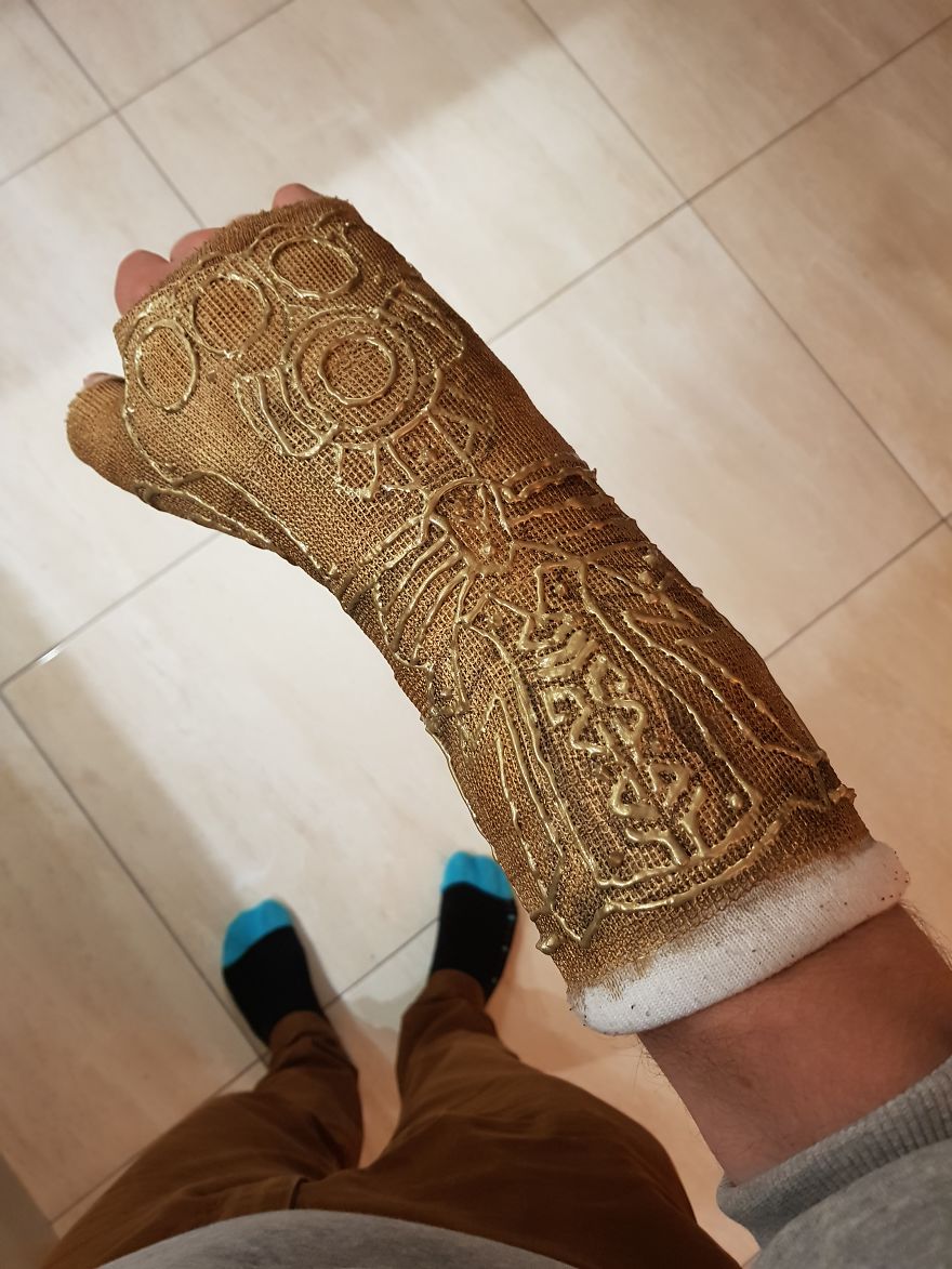 Après m’être cassé le poignet, j’ai transformé mon plâtre en « Gant de l’Infini » de Thanos