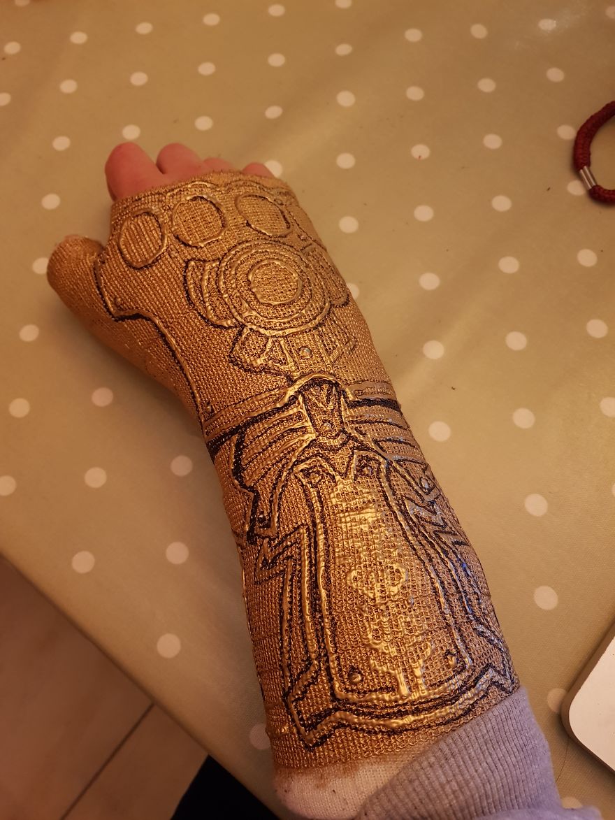 Après m’être cassé le poignet, j’ai transformé mon plâtre en « Gant de l’Infini » de Thanos
