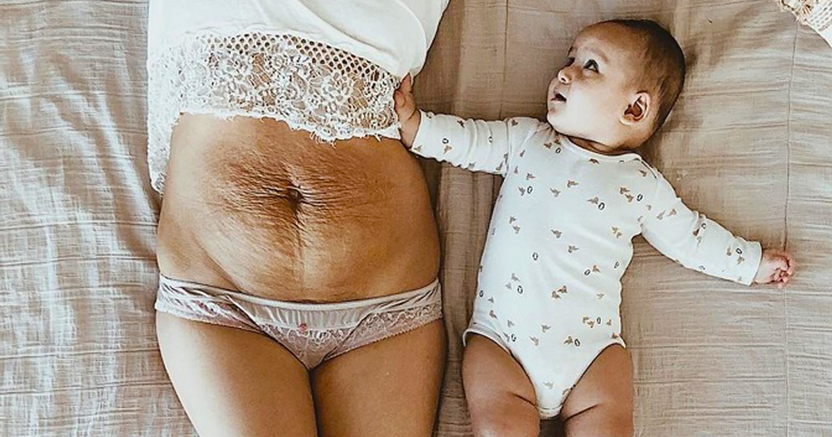Une mère de 5 enfants publie une photo de son ventre pour prouver que le corps de la femme est toujours magnifique et le soutien qu’elle reçoit est énorme