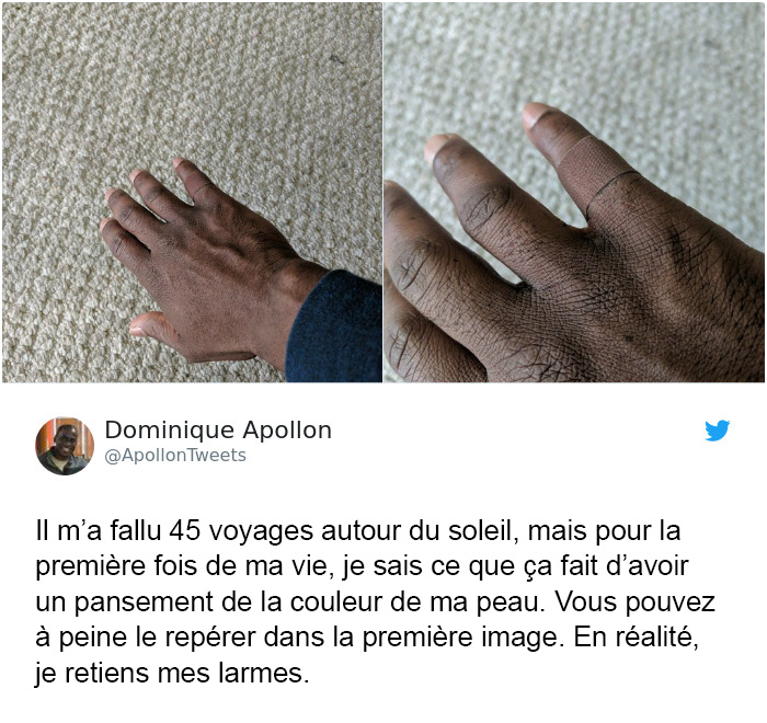 Mettre un pansement qui se confond avec sa peau a suscité une réaction émotionnelle chez cet homme