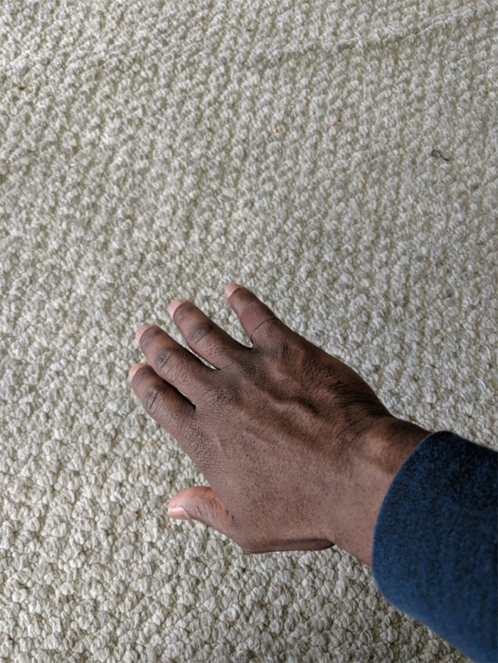 Mettre un pansement qui se confond avec sa peau a suscité une réaction émotionnelle chez cet homme