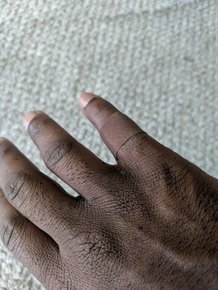 Mettre un pansement qui se confond avec sa peau a suscité une réaction émotionnelle chez cet homme