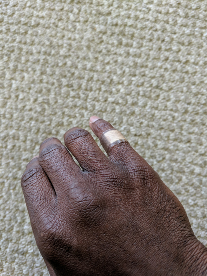 Mettre un pansement qui se confond avec sa peau a suscité une réaction émotionnelle chez cet homme