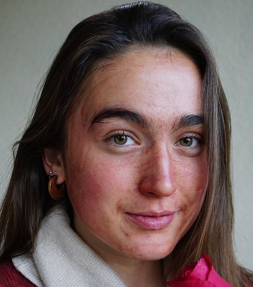 Cette femme utilise le sang de ses règles comme masque facial pour « traiter les poussées d’acné »