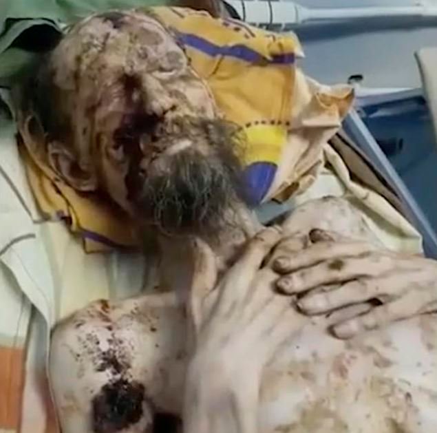 Un homme pris pour une momie a été sauvé de la tanière d’un ours après un mois