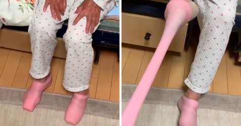 Une grand-mère a pris les jouets sexuels de son fils pour des chaussettes thermiques et a eu beaucoup de mal à les enlever
