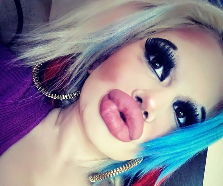 Cette femme qui a triplé la taille de ses lèvres pour être « plus à la mode » montre à quoi elle ressemblait avant