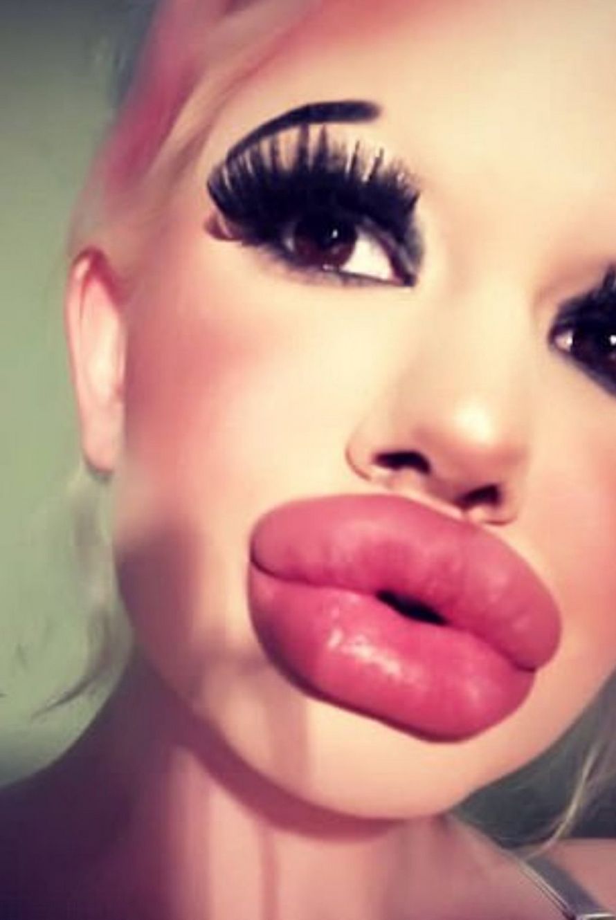 Cette femme qui a triplé la taille de ses lèvres pour être « plus à la mode » montre à quoi elle ressemblait avant