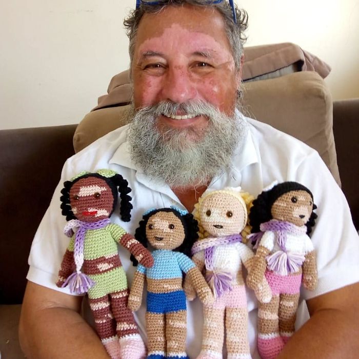 Ce grand-père est atteint de vitiligo et crochète des poupées pour aider les enfants avec cette maladie à se sentir mieux