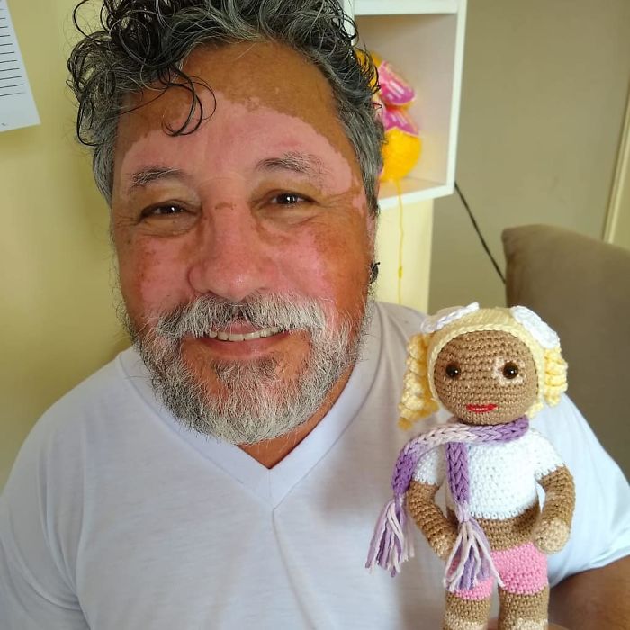 Ce grand-père est atteint de vitiligo et crochète des poupées pour aider les enfants avec cette maladie à se sentir mieux