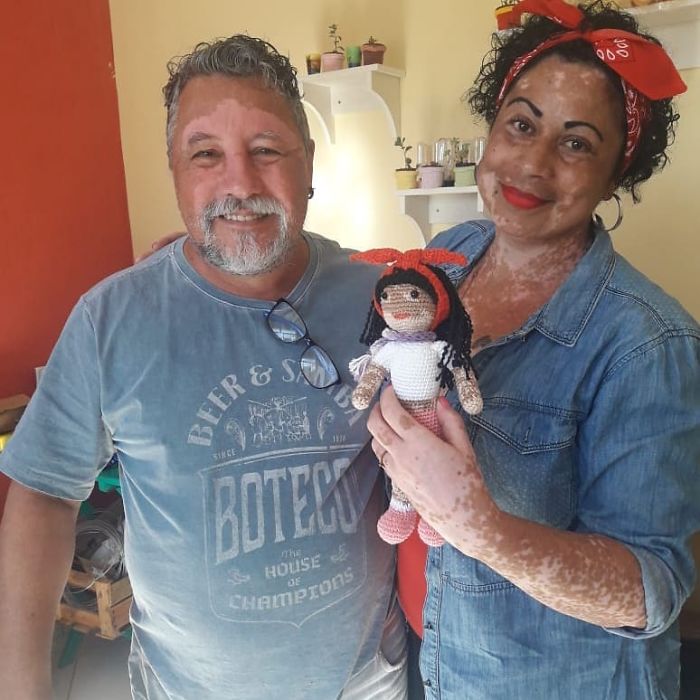 Ce grand-père est atteint de vitiligo et crochète des poupées pour aider les enfants avec cette maladie à se sentir mieux