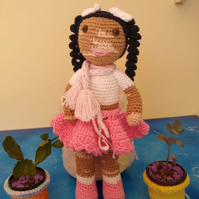 Ce grand-père est atteint de vitiligo et crochète des poupées pour aider les enfants avec cette maladie à se sentir mieux