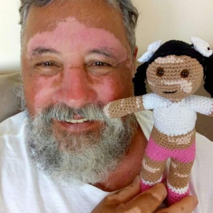 Ce grand-père est atteint de vitiligo et crochète des poupées pour aider les enfants avec cette maladie à se sentir mieux
