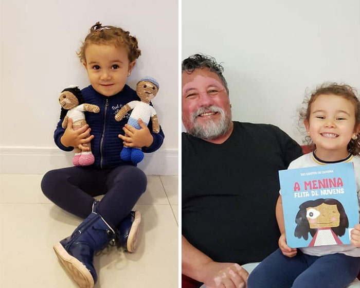 Ce grand-père est atteint de vitiligo et crochète des poupées pour aider les enfants avec cette maladie à se sentir mieux