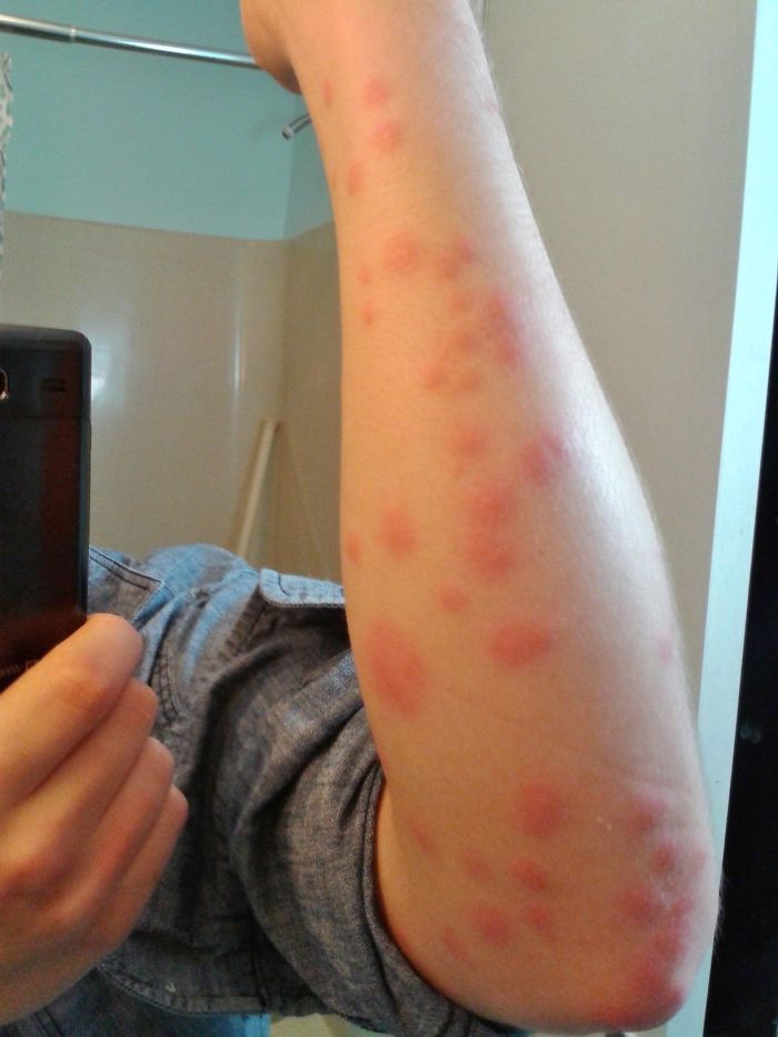 22 personnes qui ont partagé des photos des pires hôtels où elles ont séjourné